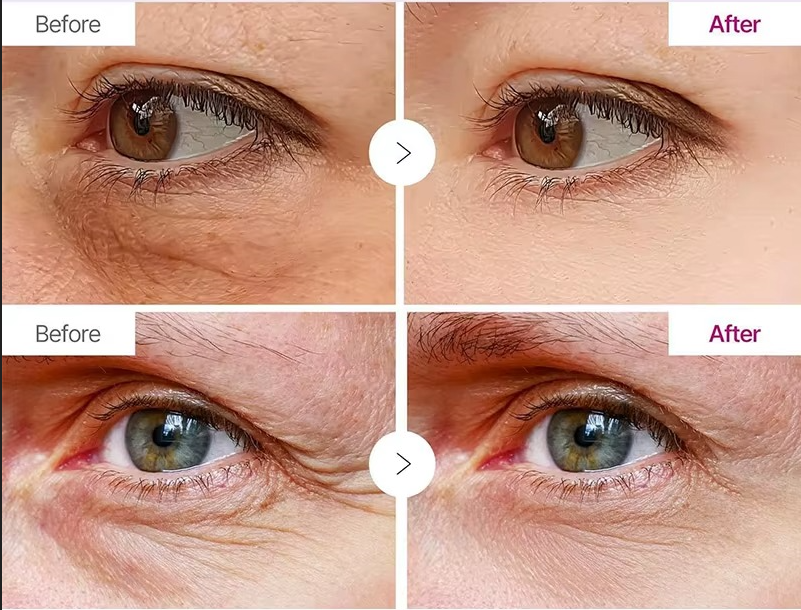 Anti Aging Balm